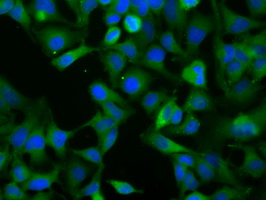 NXNL2 Antibody - Immunofluorescent staining of HeLa cells using anti-NXNL2 mouse monoclonal antibody.