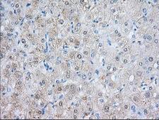 NXNL2 Antibody - IHC of paraffin-embedded Human liver tissue using anti-NXNL2 mouse monoclonal antibody. (Dilution 1:50).