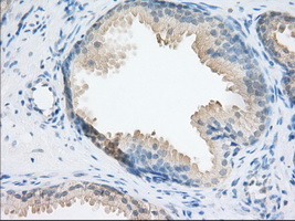 NXNL2 Antibody - IHC of paraffin-embedded Human prostate tissue using anti-NXNL2 mouse monoclonal antibody. (Dilution 1:50).