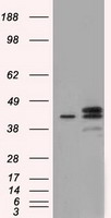 NXNL2 Antibody - HEK293T cells were transfected with the pCMV6-ENTRY control (Left lane) or pCMV6-ENTRY NXNL2 (Right lane) cDNA for 48 hrs and lysed. Equivalent amounts of cell lysates (5 ug per lane) were separated by SDS-PAGE and immunoblotted with anti-NXNL2.