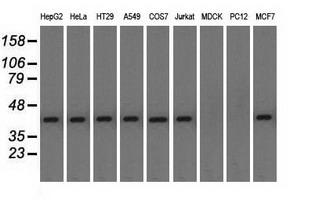 NXNL2 Antibody - Western blot of extracts (35 ug) from 9 different cell lines by using anti-NXNL2 monoclonal antibody.