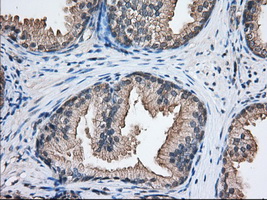 NXNL2 Antibody - IHC of paraffin-embedded Human prostate tissue using anti-NXNL2 mouse monoclonal antibody. (Dilution 1:50).