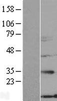 NXNL2 Protein - Western validation with an anti-DDK antibody * L: Control HEK293 lysate R: Over-expression lysate