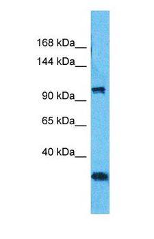 NXP2 / MORC3 Antibody - Western blot of MORC3 Antibody with human 293T Whole Cell lysate.  This image was taken for the unconjugated form of this product. Other forms have not been tested.