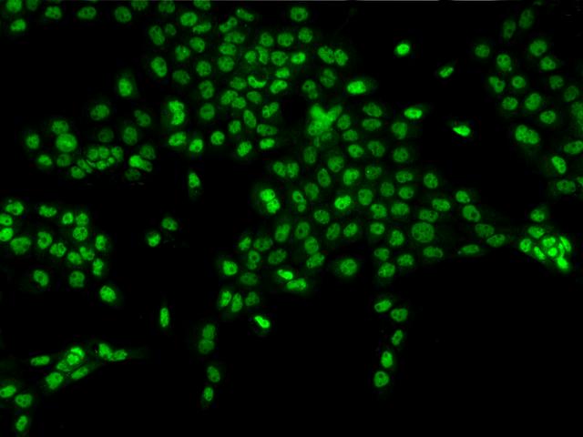 NXP2 / MORC3 Antibody - Immunofluorescence staining of MORC3 in A431 cells. Cells were fixed with 4% PFA, permeabilzed with 0.1% Triton X-100 in PBS, blocked with 10% serum, and incubated with rabbit anti-Human MORC3 polyclonal antibody (dilution ratio 1:200) at 4°C overnight. Then cells were stained with the Alexa Fluor 488-conjugated Goat Anti-rabbit IgG secondary antibody (green). Positive staining was localized to Nucleus.