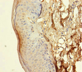 NXPE3 / FAM55C Antibody - Immunohistochemistry of paraffin-embedded human skin tissue using NXPE3 Antibody at dilution of 1:100