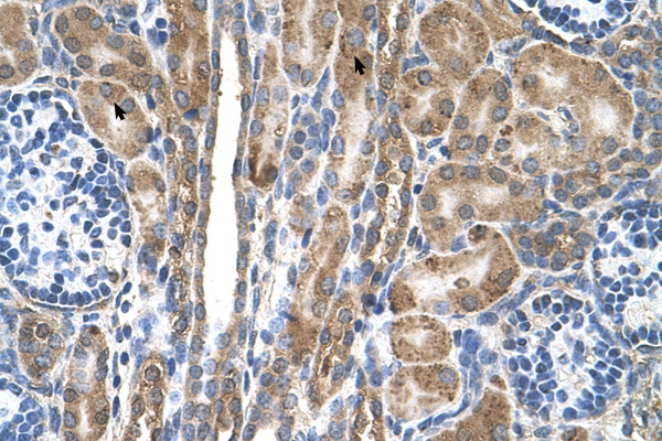 NXPE4 / FAM55D Antibody - FAM55D antibody ARP45013_T100-NP_001071107-FAM55D(family with sequence similarity 55, member D) Antibody IHC of formalin-fixed, paraffin-embedded human Kidney. Positive label: Epithelial cells of renal tubule indicated with arrows. Antibody concentration 4-8 ug/ml. Magnification 400X.  This image was taken for the unconjugated form of this product. Other forms have not been tested.