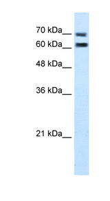 NXPE4 / FAM55D Antibody - FAM55D antibody ARP45013_T100-NP_001071107-FAM55D(family with sequence similarity 55, member D) Antibody Western blot of Jurkat lysate.  This image was taken for the unconjugated form of this product. Other forms have not been tested.