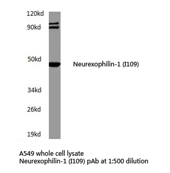 NXPH1 Antibody - Western blot of Neurexophilin-1 (I109) pAb in extracts from A549 cells.