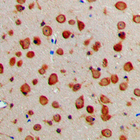NXPH1 Antibody - Immunohistochemical analysis of NXPH1 staining in human brain formalin fixed paraffin embedded tissue section. The section was pre-treated using heat mediated antigen retrieval with sodium citrate buffer (pH 6.0). The section was then incubated with the antibody at room temperature and detected using an HRP conjugated compact polymer system. DAB was used as the chromogen. The section was then counterstained with hematoxylin and mounted with DPX.