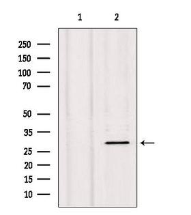 NXPH1 Antibody - Western blot analysis of extracts of HepG2 cells using NXPH1 antibody. Lane 1 was treated with the blocking peptide.