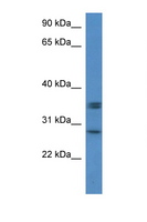 NXPH1 Antibody - NXPH1 antibody Western blot of Small Intestine lysate. Antibody concentration 1 ug/ml. This image was taken for the unconjugated form of this product. Other forms have not been tested.