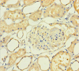 NXPH2 Antibody - Immunohistochemistry of paraffin-embedded human kidney tissue using NXPH2 Antibody at dilution of 1:100
