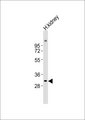 NXPH2 Antibody - Anti-NXPH2 Antibody at 1:500 dilution + human kidney lysates Lysates/proteins at 20 ug per lane. Secondary Goat Anti-Rabbit IgG, (H+L),Peroxidase conjugated at 1/10000 dilution Predicted band size : 30 kDa Blocking/Dilution buffer: 5% NFDM/TBST.