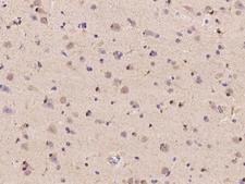 NXPH2 Antibody - Immunochemical staining of human NXPH2 in human brain with rabbit polyclonal antibody at 1:500 dilution, formalin-fixed paraffin embedded sections.