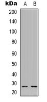 NXPH3 / Neurexophilin 3 Antibody - Western blot analysis of NXPH3 expression in A549 (A); HT29 (B) whole cell lysates.