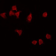 NXPH3 / Neurexophilin 3 Antibody - Staining HT29 cells by IF/ICC. The samples were fixed with PFA and permeabilized in 0.1% Triton X-100, then blocked in 10% serum for 45 min at 25°C. The primary antibody was diluted at 1:200 and incubated with the sample for 1 hour at 37°C. An Alexa Fluor 594 conjugated goat anti-rabbit IgG (H+L) Ab, diluted at 1/600, was used as the secondary antibody.