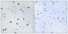 NXPH4 Antibody - Immunohistochemistry analysis of paraffin-embedded human brain tissue, using NXPH4 Antibody. The picture on the right is blocked with the synthesized peptide.