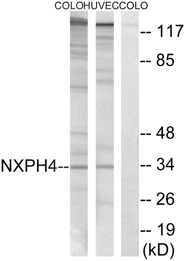 NXPH4 Antibody - Western blot analysis of lysates from COLO and HUVEC cells, using NXPH4 Antibody. The lane on the right is blocked with the synthesized peptide.