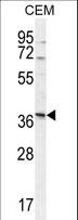 NXPH4 Antibody - NXPH4 Antibody western blot of CEM cell line lysates (35 ug/lane). The NXPH4 antibody detected the NXPH4 protein (arrow).