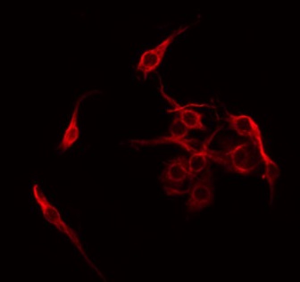 NXPH4 Antibody - Staining COLO205 cells by IF/ICC. The samples were fixed with PFA and permeabilized in 0.1% Triton X-100, then blocked in 10% serum for 45 min at 25°C. The primary antibody was diluted at 1:200 and incubated with the sample for 1 hour at 37°C. An Alexa Fluor 594 conjugated goat anti-rabbit IgG (H+L) Ab, diluted at 1/600, was used as the secondary antibody.