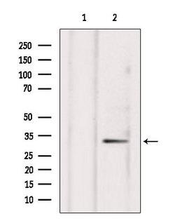 NXPH4 Antibody - Western blot analysis of extracts of HepG2 cells using NXPH4 antibody. Lane 1 was treated with the blocking peptide.