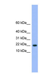 NXT1 Antibody - NXT1 antibody Western blot of Fetal Liver lysate. This image was taken for the unconjugated form of this product. Other forms have not been tested.