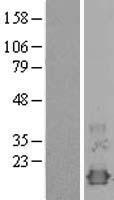 NXT1 Protein - Western validation with an anti-DDK antibody * L: Control HEK293 lysate R: Over-expression lysate