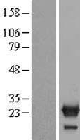 NXT2 Protein - Western validation with an anti-DDK antibody * L: Control HEK293 lysate R: Over-expression lysate