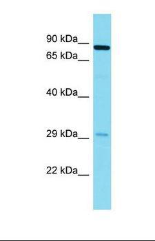 NYAP2 Antibody - Western blot of Human Fetal Lung. NYAP2 antibody dilution 1.0 ug/ml.  This image was taken for the unconjugated form of this product. Other forms have not been tested.