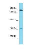 NYAP2 Antibody - Western blot of Human Fetal Lung. NYAP2 antibody dilution 1.0 ug/ml.  This image was taken for the unconjugated form of this product. Other forms have not been tested.