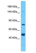NYAP2 Antibody - NYAP2 antibody Western Blot of Thymus Tumor. Antibody dilution: 1 ug/ml.  This image was taken for the unconjugated form of this product. Other forms have not been tested.