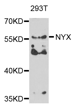 NYX Antibody - Western blot analysis of extracts of 293T cells.