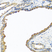 NYX Antibody - Immunohistochemistry of paraffin-embedded human prostate.