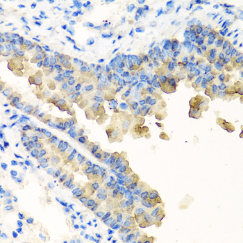 NYX Antibody - Immunohistochemistry of paraffin-embedded mouse lung tissue.