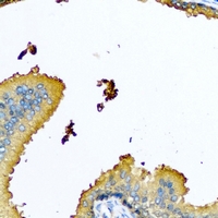 NYX Antibody - Immunohistochemical analysis of Nyctalopin staining in human prostate formalin fixed paraffin embedded tissue section. The section was pre-treated using heat mediated antigen retrieval with sodium citrate buffer (pH 6.0). The section was then incubated with the antibody at room temperature and detected using an HRP conjugated compact polymer system. DAB was used as the chromogen. The section was then counterstained with hematoxylin and mounted with DPX.