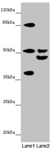 NYX Antibody - Western blot All Lanes: NYX antibody at 7.23 ug/ml Lane 1: Mouse gonadal tissue Lane 2: Mouse liver tissue Secondary Goat polyclonal to rabbit IgG at 1/10000 dilution Predicted band size: 52 kDa Observed band size: 52,37,45,90 kDa