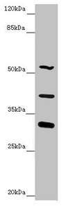 NYX Antibody - Western blot All Lanes:NYX antibody at 4.91 ug/ml + Mouse liver tissue Secondary Goat polyclonal to rabbit IgG at 1/10000 dilution Predicted band size: 52 kDa Observed band size: 52,32,39 kDa