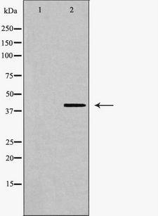 O3FAR1 / GPR120 Antibody - Western blot analysis of GPR120 expression in PC-12 cells. The lane on the left is treated with the antigen-specific peptide.