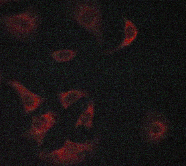 O3FAR1 / GPR120 Antibody - Staining LOVO cells by IF/ICC. The samples were fixed with PFA and permeabilized in 0.1% saponin prior to blocking in 10% serum for 45 min at 37°C. The primary antibody was diluted 1/400 and incubated with the sample for 1 hour at 37°C. A Alexa Fluor® 594 conjugated goat polyclonal to rabbit IgG (H+L), diluted 1/600 was used as secondary antibody.