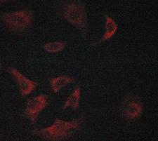 O3FAR1 / GPR120 Antibody - Staining LOVO cells by IF/ICC. The samples were fixed with PFA and permeabilized in 0.1% saponin prior to blocking in 10% serum for 45 min at 37°C. The primary antibody was diluted 1/400 and incubated with the sample for 1 hour at 37°C. A Alexa Fluor® 594 conjugated goat polyclonal to rabbit IgG (H+L), diluted 1/600 was used as secondary antibody.