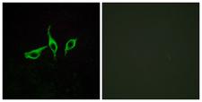 O3FAR1 / GPR120 Antibody - Peptide - + Immunofluorescence analysis of LOVO cells, using GPR120 antibody.