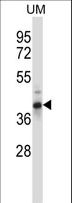 OAF Antibody - OAF Antibody western blot of human uterine tumor tissue lysates (35 ug/lane). The OAF antibody detected the OAF protein (arrow).