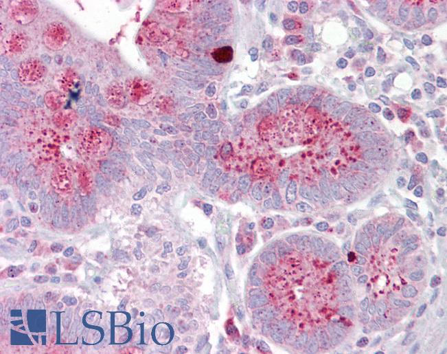 OAS1 Antibody - Anti-OAS1 antibody IHC of human small intestine. Immunohistochemistry of formalin-fixed, paraffin-embedded tissue after heat-induced antigen retrieval. Antibody concentration 5 ug/ml.  This image was taken for the unconjugated form of this product. Other forms have not been tested.