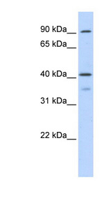 OAS1 Antibody - OAS1 antibody Western blot of Transfected 293T cell lysate. This image was taken for the unconjugated form of this product. Other forms have not been tested.