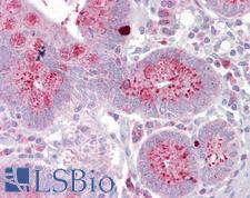 OAS1 Antibody - Anti-OAS1 antibody IHC of human small intestine. Immunohistochemistry of formalin-fixed, paraffin-embedded tissue after heat-induced antigen retrieval. Antibody concentration 5 ug/ml.  This image was taken for the unconjugated form of this product. Other forms have not been tested.