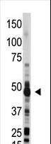 OAS1 Antibody - The anti-OAS1 antibody is used in Western blot to detect OAS1 in mouse liver lysate.