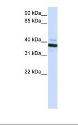 OAS1 Antibody - Fetal heart lysate. Antibody concentration: 1.0 ug/ml. Gel concentration: 12%.  This image was taken for the unconjugated form of this product. Other forms have not been tested.
