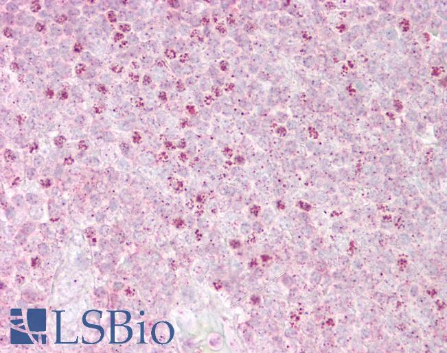 OAS1 Antibody - Anti-OAS1 antibody IHC of human tonsil. Immunohistochemistry of formalin-fixed, paraffin-embedded tissue after heat-induced antigen retrieval. Antibody concentration 5 ug/ml.  This image was taken for the unconjugated form of this product. Other forms have not been tested.