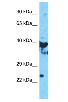 OAS1 Antibody - OAS1 antibody Western Blot of HepG2. Antibody dilution: 1 ug/ml.  This image was taken for the unconjugated form of this product. Other forms have not been tested.